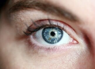 Free Cataracts Surgery Opportunity Woman Eye Lashes Blue Eye Portrait Eye Skin Girl