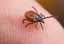 Tick Bites: Prevention, Removal, and Seeking Treatment Image (2)