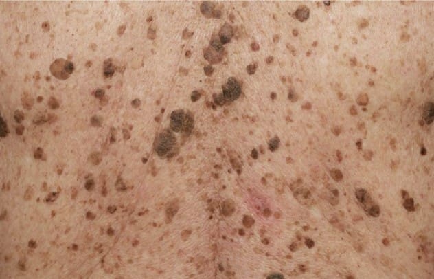 Image2