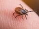Tick Bites: Prevention, Removal, and Seeking Treatment Image (2)